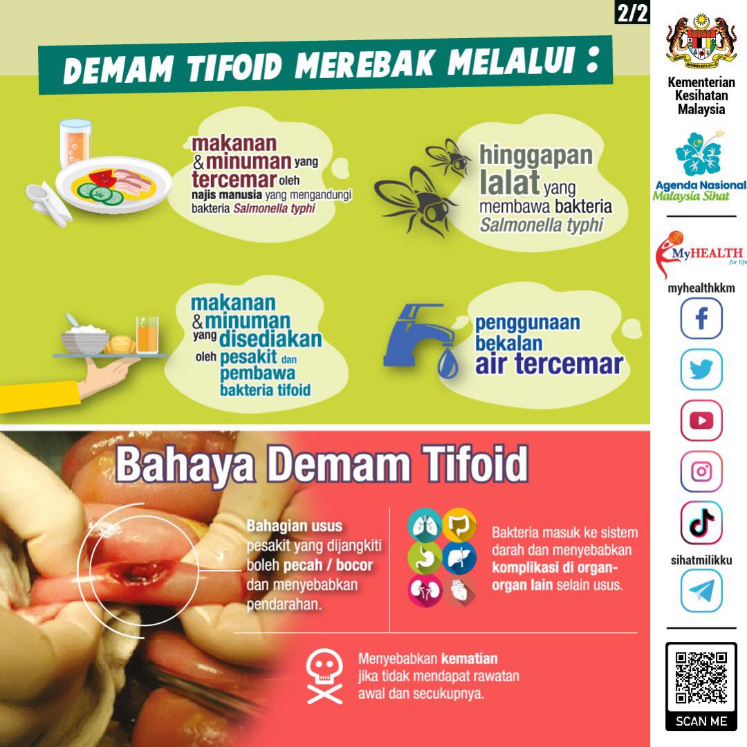Demam Tifoid Kepialu 2